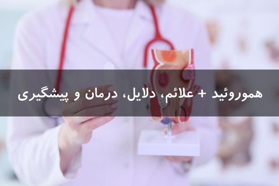 هموروئید+علائم، دلایل و درمان