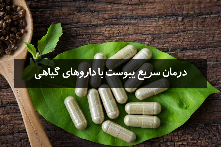 10 روش درمان یبوست با داروهای گیاهی